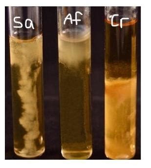 E Coli Staphylococcus Aureus And Pseudomonas Aeruginosa, 51% OFF