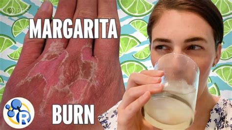 Why Lime Juice Burns Your Skin In The Sun Vi Eurekalert