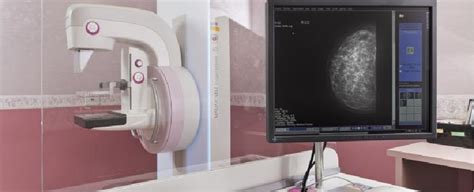 Digital Mammography