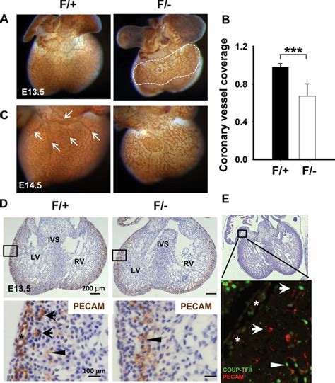 Endocardial Cushion Morphogenesis And Coronary Vessel Development