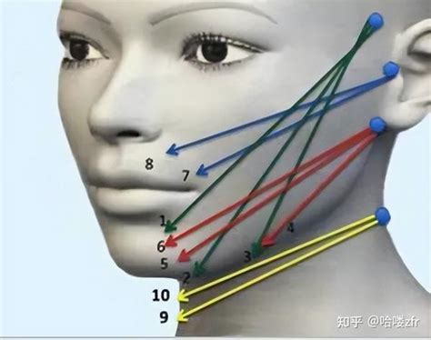 太全了！线雕后多久皮肤开始变紧，线雕多久才能看到效果！ 知乎