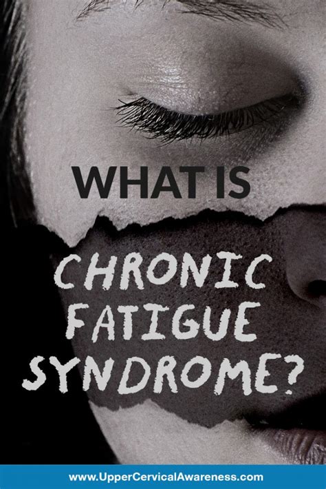 What Is Chronic Fatigue Syndrome?