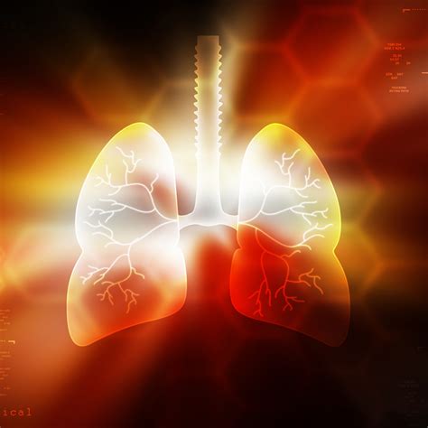 The Conundrum of Open Lung Biopsy in Critically Ill Patients | 2015-12 ...