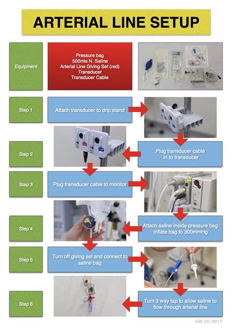 Arterial Line Diagram