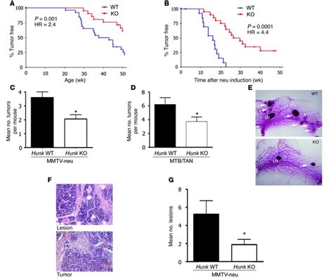 Jci Hunk Is Required For Her Neu Induced Mammary Tumorigenesis