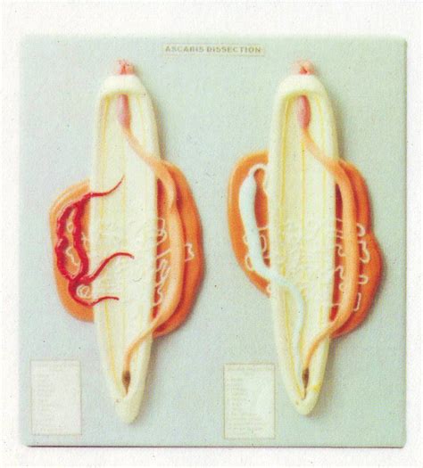 Ascaris Dissection Male And Female