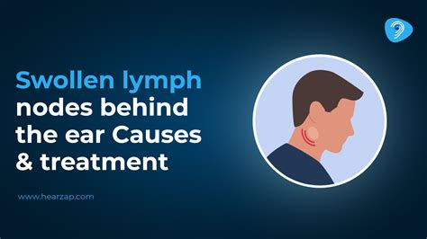 Swollen Lymph Nodes Behind Ear: Causes & Treatment