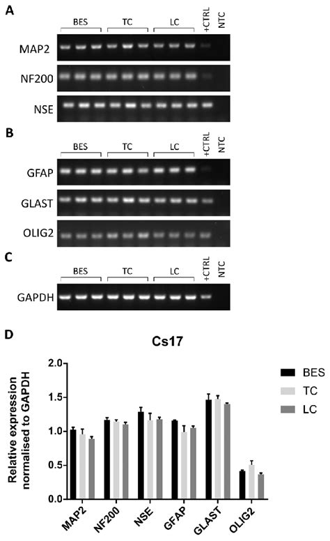 Expression Of Neural Markers In HNSCs Neuronally Differentiated For 4