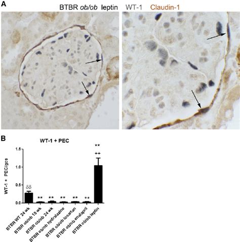 Expression Of Wt By Pecs In Btbr Ob Ob Mice With Leptin Replacement