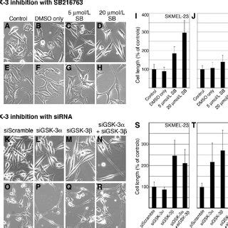 Gsk Inhibition Induces Apoptosis In Melanoma Cells Overall