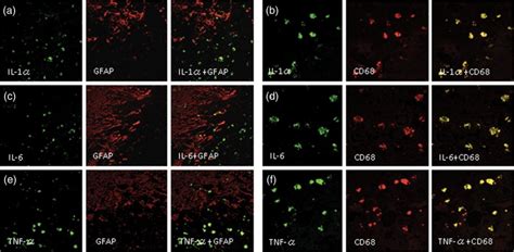 Double Immunofluorescence Staining Of Case Il Il And Tnf