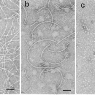 Electron Micrographs Of Negatively Stained Preparations Uranyl