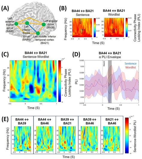 A Interregional Phase Locking Differences Of Oscillatory Activity