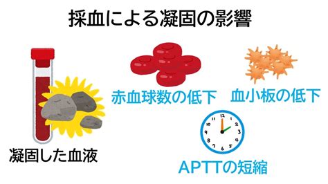 採血による凝固の影響 臨床検査のお役立ち情報