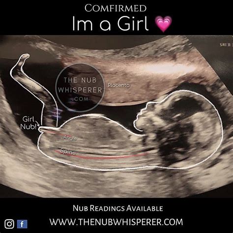 Home The Nub Whisperer Ltd Gender Prediction Ultrasound Boy Or