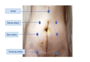 Inspection And Auscultation Of Abdominal Vasculature Introduction To