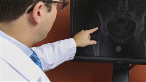 How Spinal Deformity Can Affect Hip Replacement Surgery Success Rates