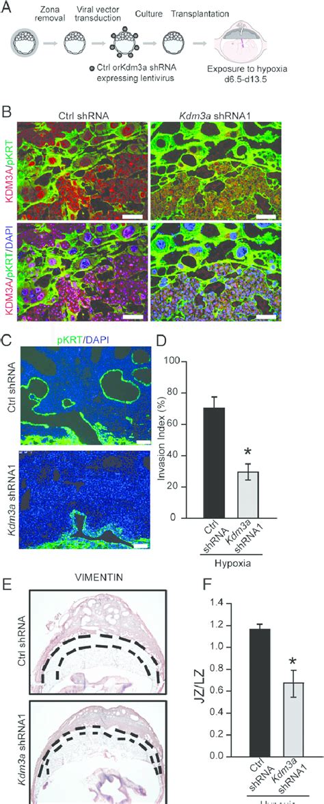 KDM3A And Hypoxia Activated Trophoblast Directed Uterine Spiral Artery