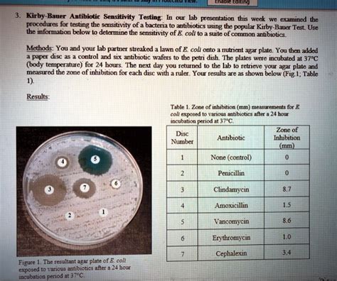 Actualizar Imagen Kirby Bauer Method Steps Abzlocal Mx