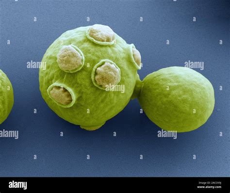 Yeast Cells Coloured Scanning Electron Micrograph SEM Of Cells Of