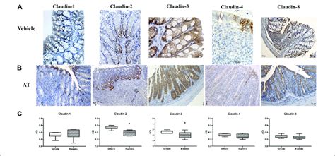 Claudin 1 Claudin 2 Claudin 3 Claudin 4 And Claudin 8 Expression