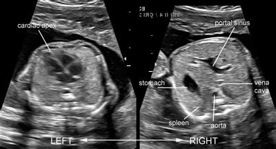 Ultrasound Atlas Glowm