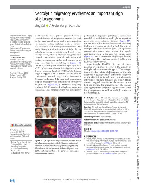 Pdf Necrolytic Migratory Erythema An Important Sign Of Glucagonoma