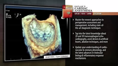 Kaplan's Cardiac Anesthesia, 6th Edition - YouTube