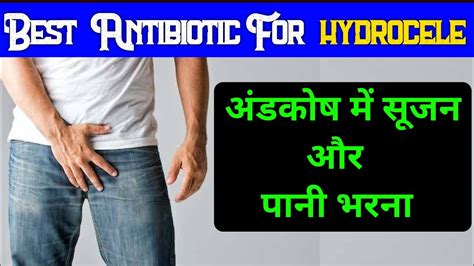 Hydrocele Best Medicine Hydrocele Treatment Testicle Swelling