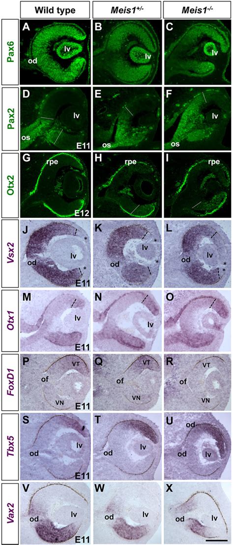 Meis Is Required To Define Proper Patterning Of The Optic Cup Along