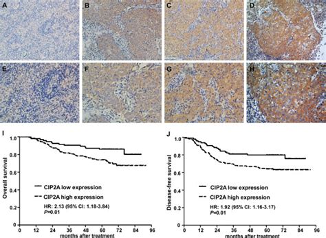 Expression Levels Of Cip2a And Survival Of Npc Patients A H Dicer1