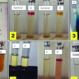 Biochemical Tests For The Identification Of Klebsiella Sp Catalase