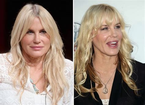 Daryl Hannah Before And After Plastic Surgery Face Lips