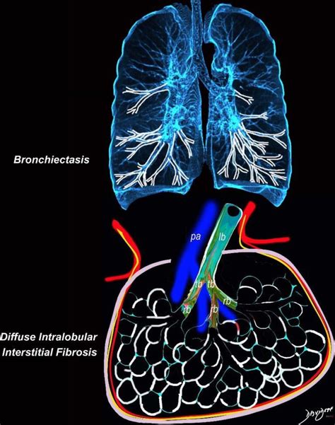 Diagrams Alveoli Lungs