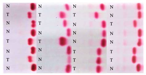 Diagnostics Free Full Text Deep Learning Assisted Automated Assessment Of Thalassaemia From