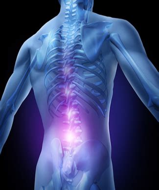 Lordosis Symptoms Midwest Neurosurgery Associates Kansas City MO