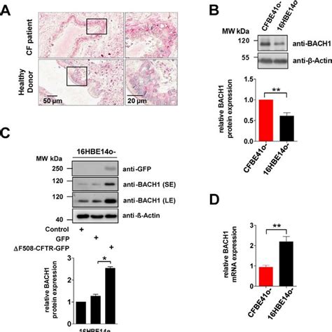 Altered Bach Expression In Cfbe O Cells A Immunohisto Chemical