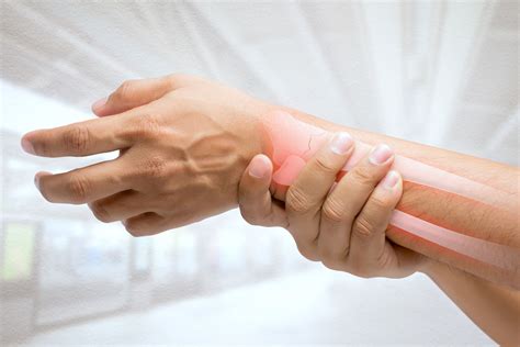 Wrist Fracture Treatment Ladan Hajipour Orthopaedic Surgeon