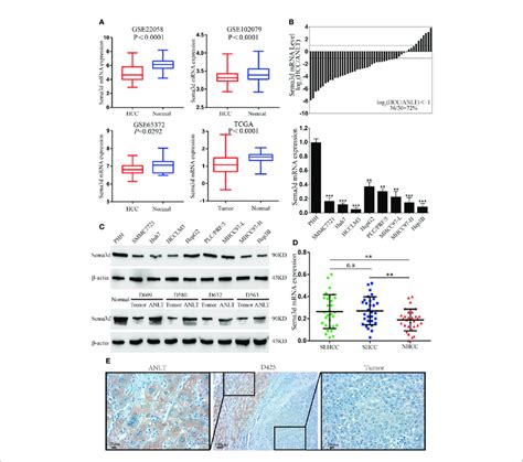 Sema D Is Downregulated In Hcc Cell Lines And Tissues A Sema D