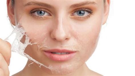 10 Home remedies for peeling skin on face and on hands