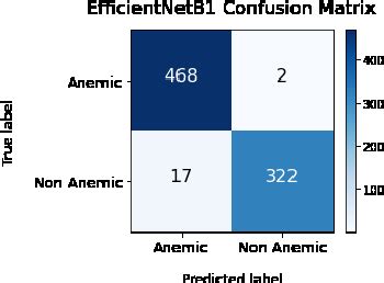 Figure 1 From EfficientNet Models For Detection Of Anemia Disorder