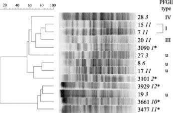 Infrequent detection of acquired metallo β lactamases among carbapenem