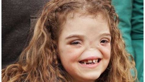 Voir le bébé mature sans nez Son éducation inhabituelle a commencé quand elle était assez jeune