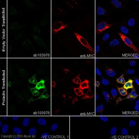 Anti Prolactin PRL 抗体 EPR19386 BSA and Azide free ab238938