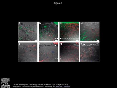 Differential Contribution Of Dermal Resident And Bone Marrowderived