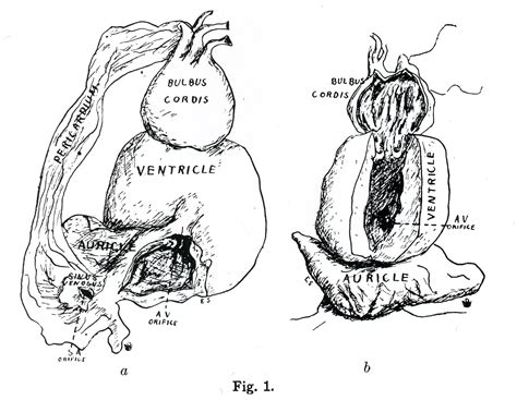 13 Heart Of Angler Maude Abbott Medical Museum Mcgill University