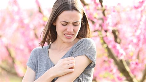 Webinar: Is It Something In the Air? Seasonal Allergies & Eczema | National Eczema Association