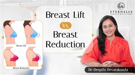 Breast Lift Vs Breast Reduction Surgery Whats The Difference