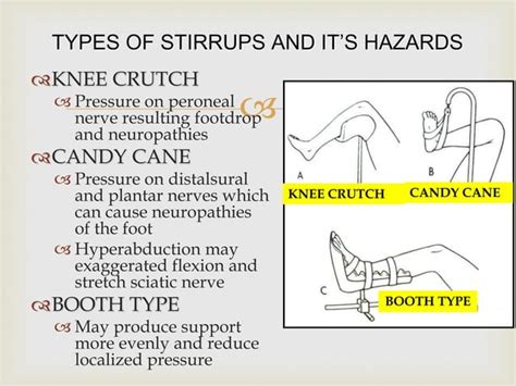 Lithotomy position abdullah | PPT