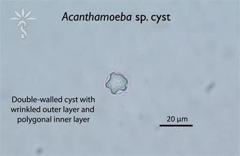 Acanthamoeba Keratitis Parasite